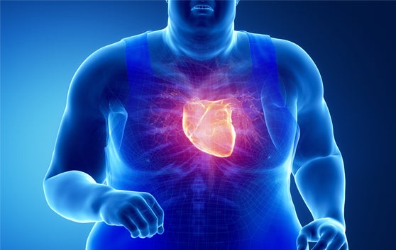 obesity and overweight factors of heart disease